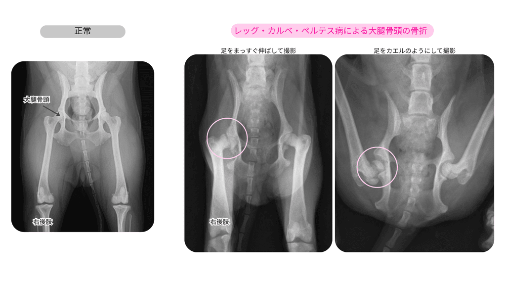 レントゲン検査：レッグペルテスと正常像の比較