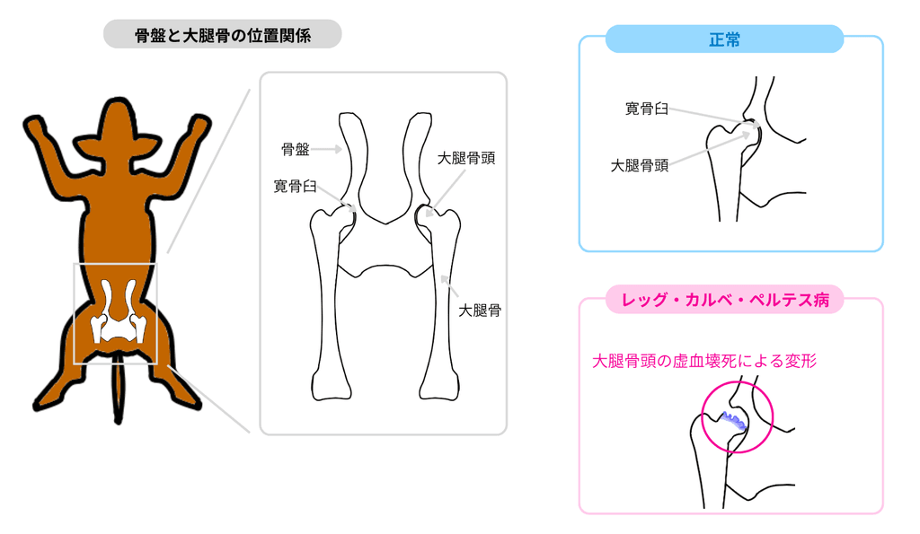 レッグペルテスとは