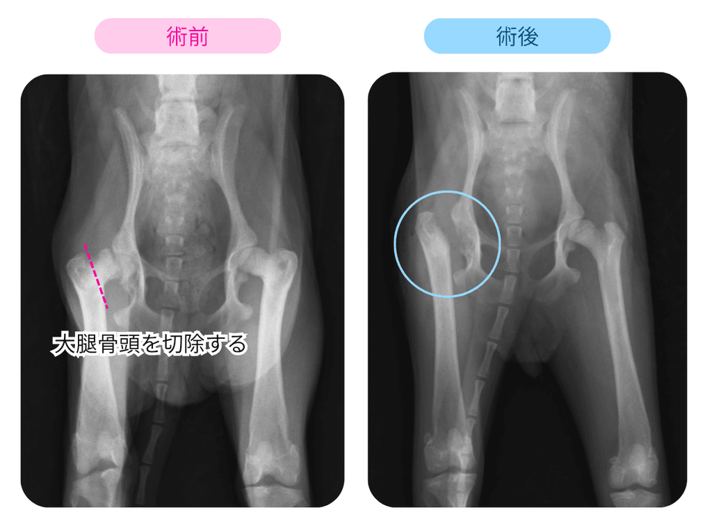 レントゲン検査：大腿骨頭切除術の前後の比較